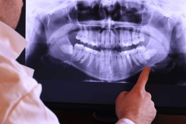 Best Pediatric Emergency Dentist in Mountain Green, UT