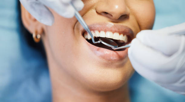 Trusted UT Emergency Dentist Experts