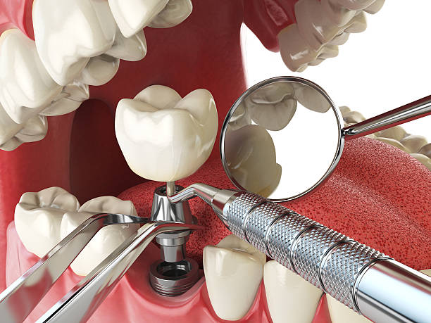 Best Pediatric Emergency Dentist in Mountain Green, UT