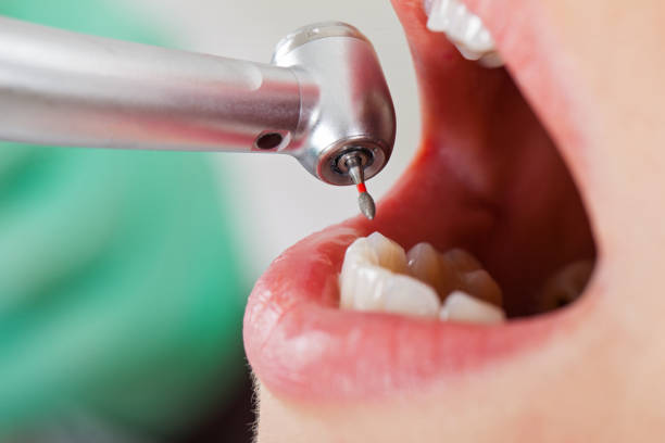 Best Emergency Broken Tooth Repair in Mountain Green, UT